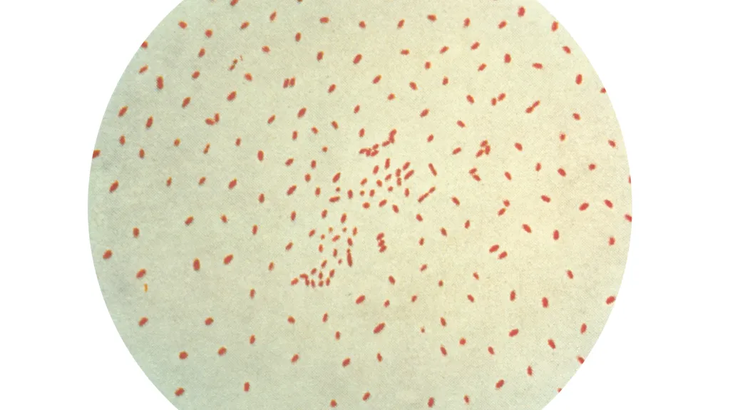 Bordetella pertussis
