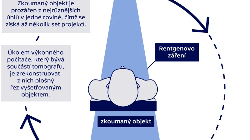 Výpočetní tomografie