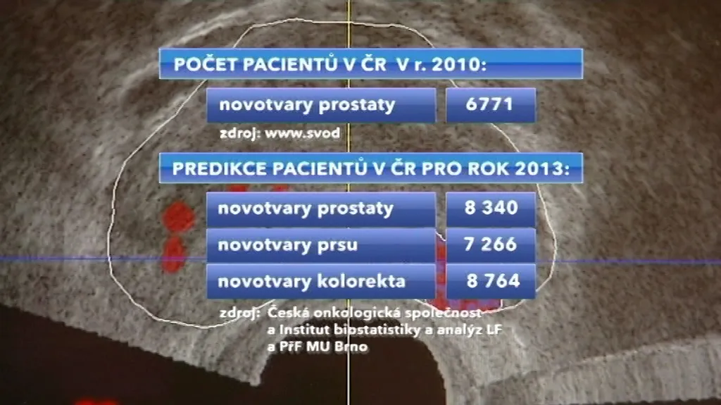 Pacienti s prostatou