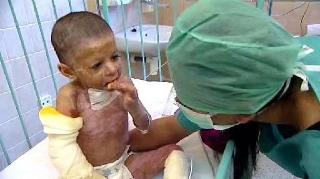 Natálka v péči lékařů