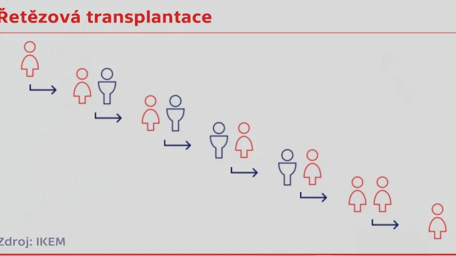 Řetězová transplantace