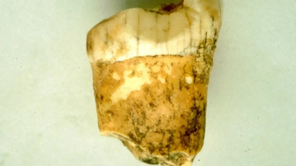 Zub zkoumaného neandertálce