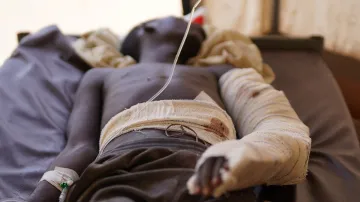 Súdánec zraněný při útoku RSF na Fášir