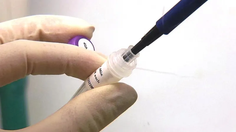 Výzkum léčby cukrovky