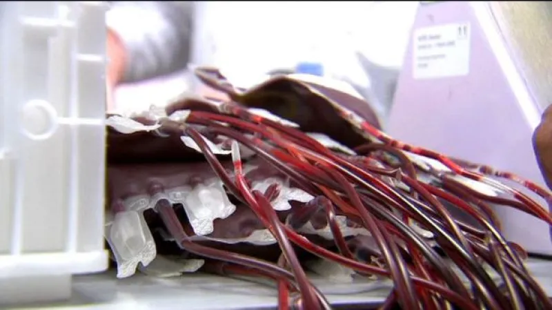 Reportáž o úmrtí "muže bez srdce"