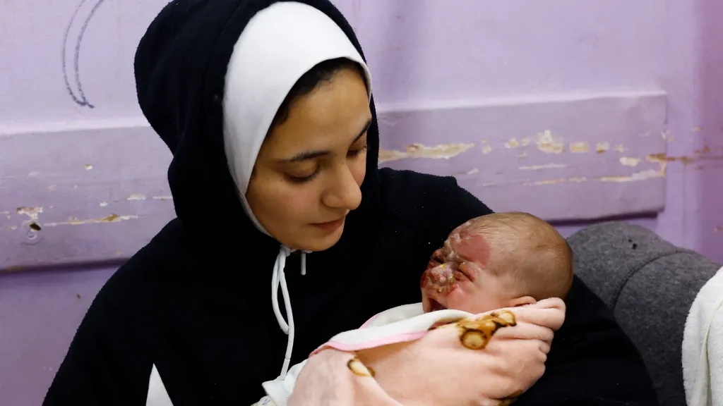 Palestinka z Pásma Gazy se svým popáleným dítětem