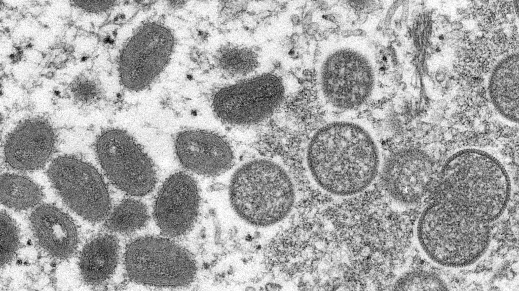 Virus opičích neštovic