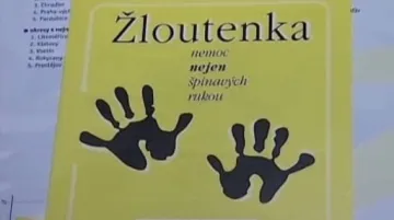 Leták varující před žloutenkou