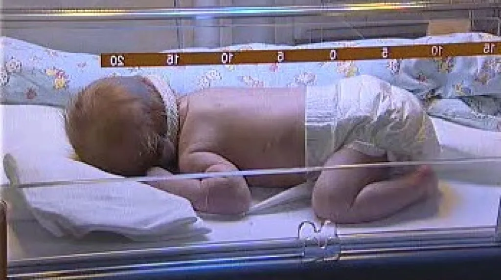 Novorozenec v inkubátoru