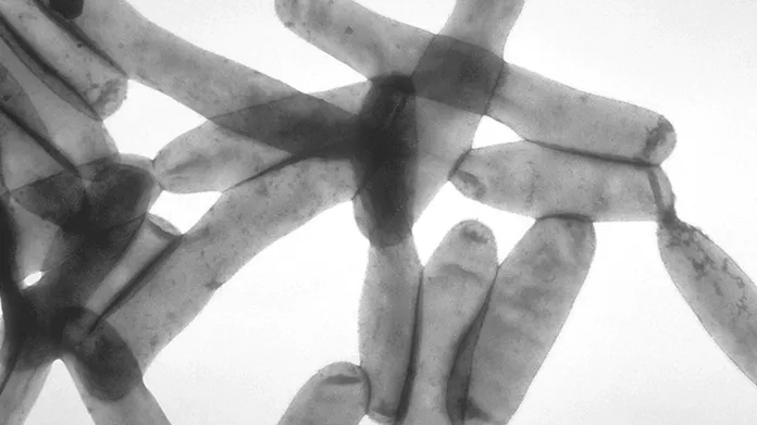 Bakterie legionelly pod mikroskopem