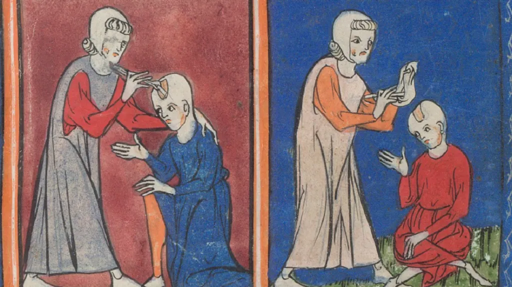 Operace před vynálezem anestezie byly riskantní