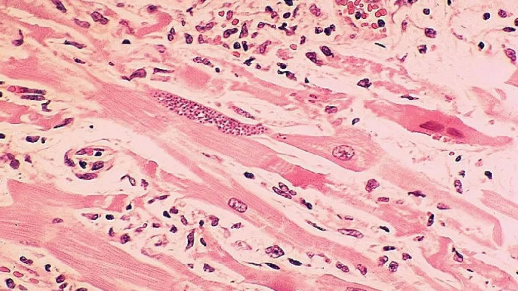 Toxoplasma gondii