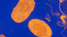 Bakterie Bordetella pertussis, která způsobuje černý kašel, pod elektronovým mikroskopem