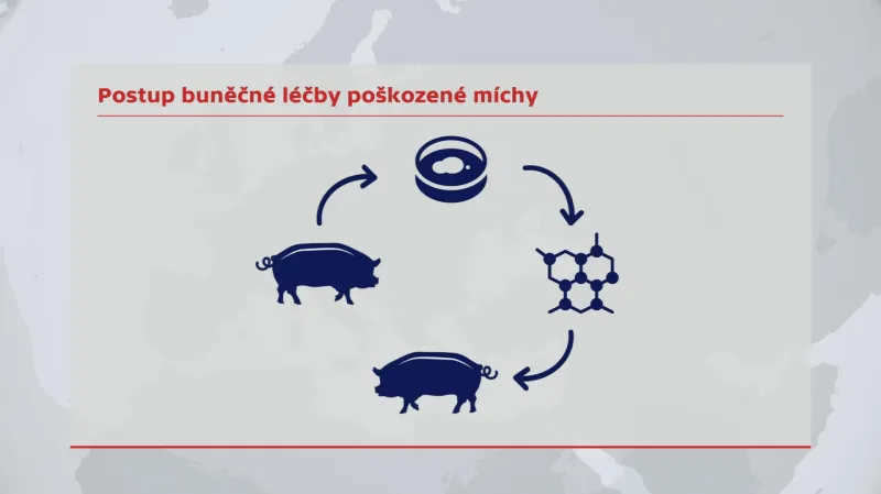 Postup buněčné léčby poškozené míchy