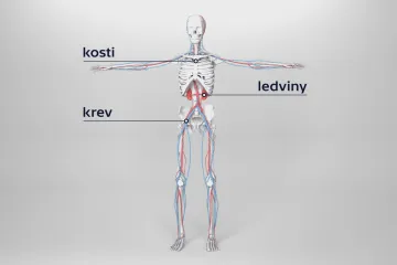 Léčba mnohočetného myelomu je čím dál úspěšnější. Nádorová nemoc neodolá novým lékům