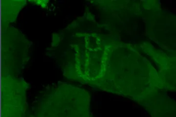 Olomoučtí vědci přišli s průlomovou metodou ke zkoumání stresu buněk