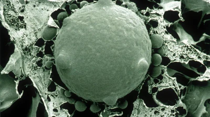 Batrachochytrium dendrobatidis