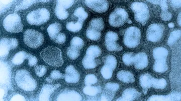 Virus ptačí chřipky