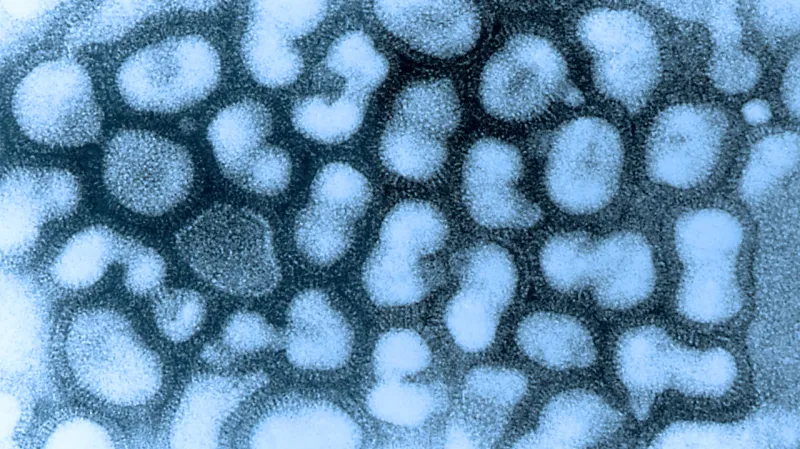 Virus ptačí chřipky