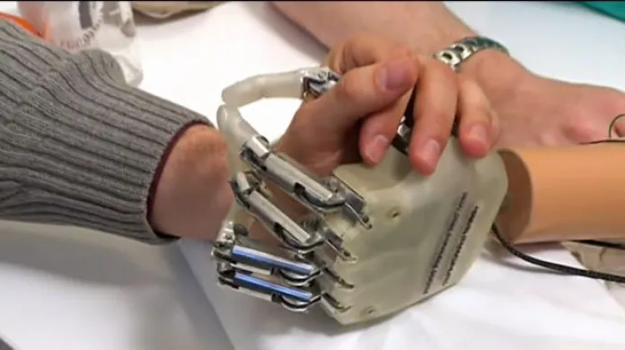 Horizont 24 o prototypu bionické ruky