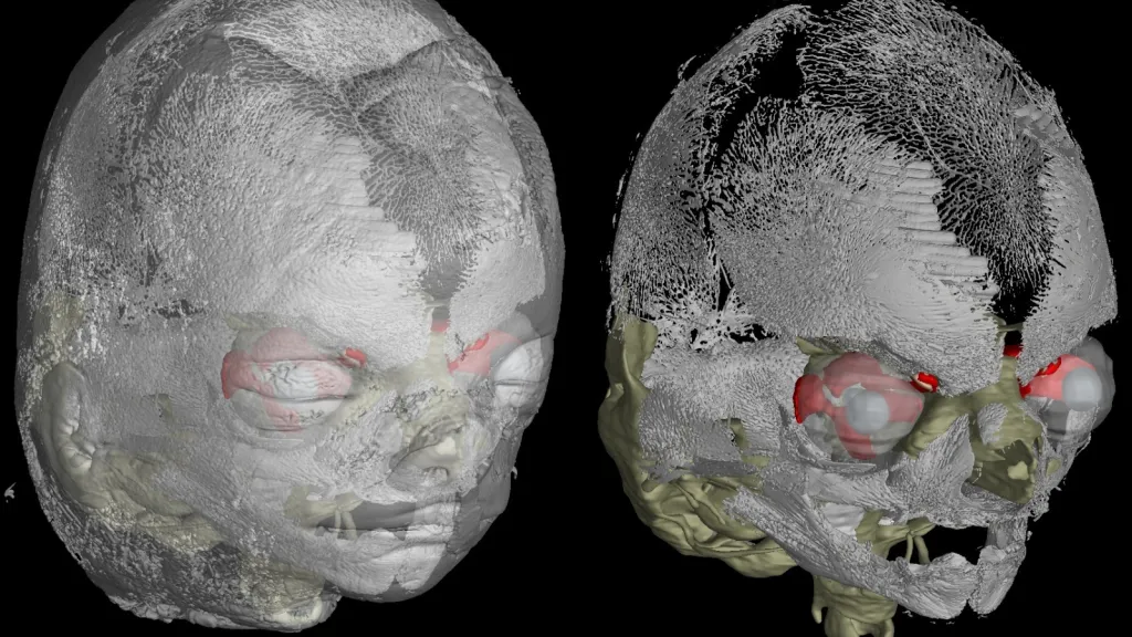 3D atlas chrupavky lidských embryí