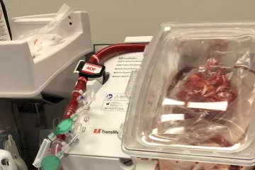 K transplantaci se převáželo bijící srdce. IKEM představil speciální přístroj