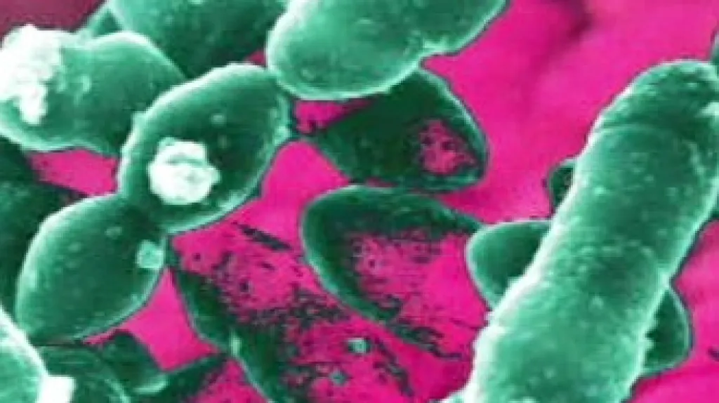 Spánkový streptokok