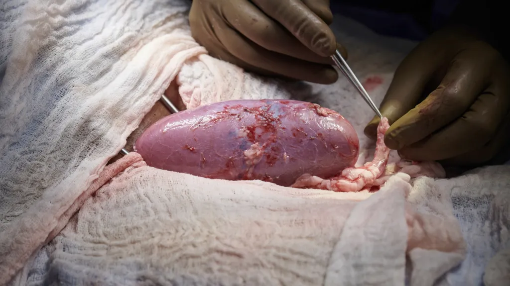 Transplantace prasečí ledviny