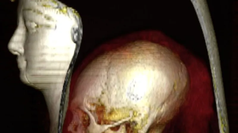 CT mumie Amenhotepa I.