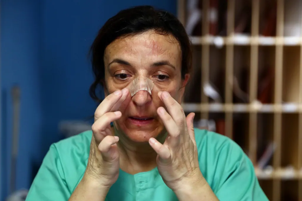 Španělská zdravotní sestra Cristina Cadenasová si upravuje náplast, která ji chrání před odřeninami od respirátoru