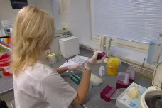 V Ostravě už testují krevní vzorky na vir zika, brzy by ho mohli odhalit i zpětně