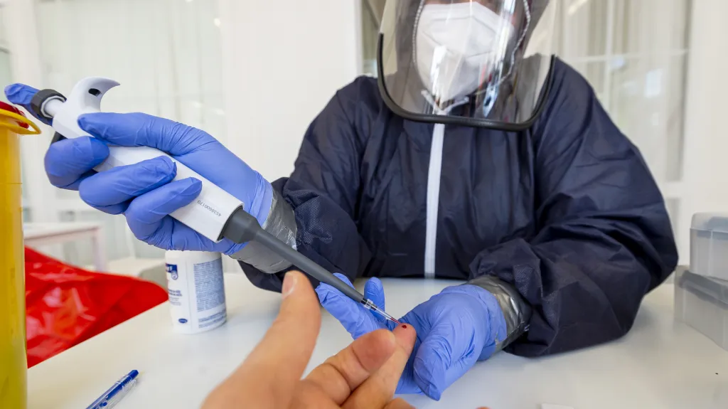 Testování pro studii kolektivní imunity