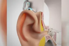 Kochleární implantáty darují sluch dětem i dospělým. Místo ticha nebo šumění slyší přirozené zvuky světa