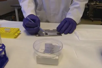 Místo mamografu otisk prstu. Umělá inteligence se naučila vyhledávat rakovinu prsu