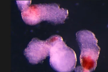 Vědci z Cambridge hlásí průlom. Vytvořili v laboratoři lidskou krev
