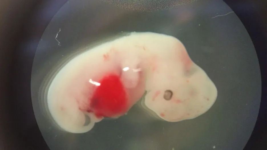 Lidsko-prasečí embryo