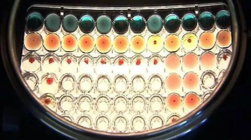 Reportáž Ladislava Kerekeše, Terezy Krásenské a Olgy Bakové