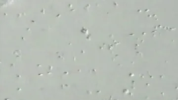 Sperma pod mikroskopem