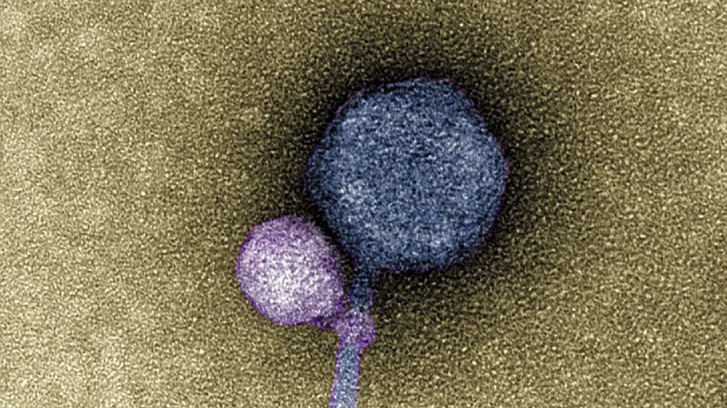 Virus a jeho přichycený satelit