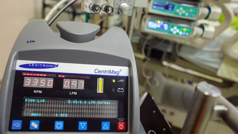 Mimotělní pumpa v provozu