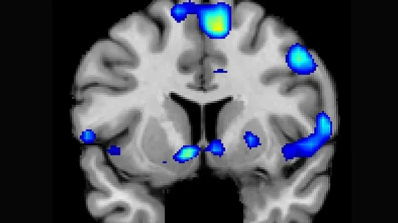 Náboženské vjemy v mozku