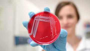 Vzorek bakterií z výzkumu brněnských vědců