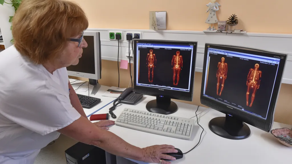 Vyhodnocení pozitronové emisní tomografie. Ilustrační foto