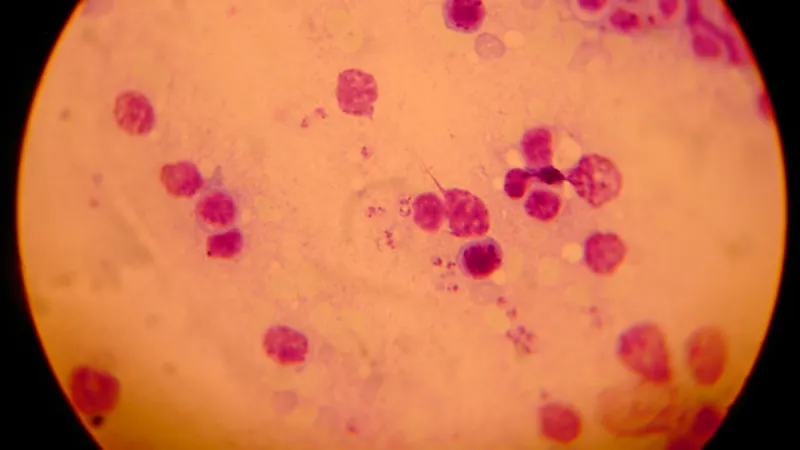 Leishmania pod mikroskopem