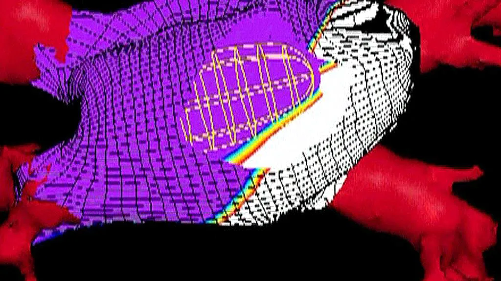 Digitální model srdce