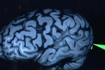 Parkinsonovu chorobu mohou porazit „přirození zabijáci“, kteří jsou součástí imunitního systému