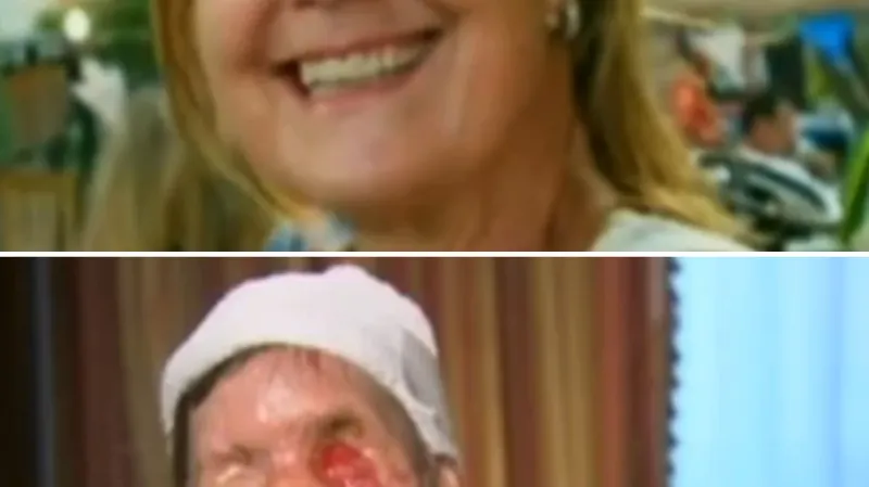 Charla Nashová před napadením šimpanzem a po něm