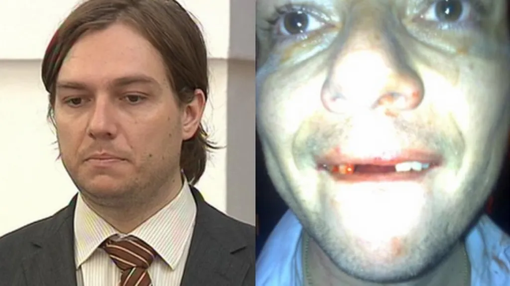 Michal Babák po rvačce