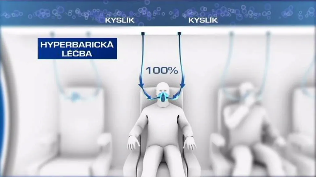 Schéma léčby v hyperbarické komoře