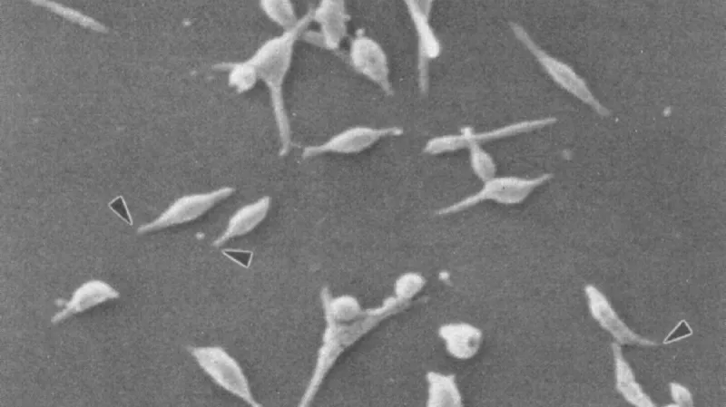 Mycoplasma pneumoniae